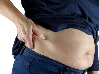 Vanlige årsaker til fedme - er fedme arvelig?